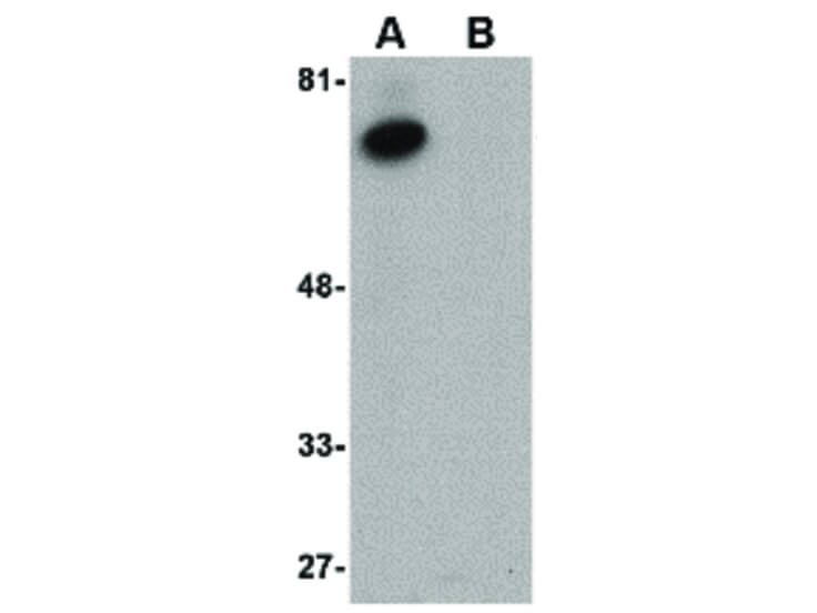 Western Blot of ACVR1B Antibody