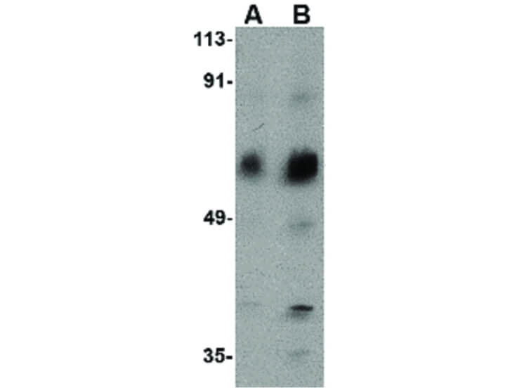 Western Blot of ACVR1C Antibody