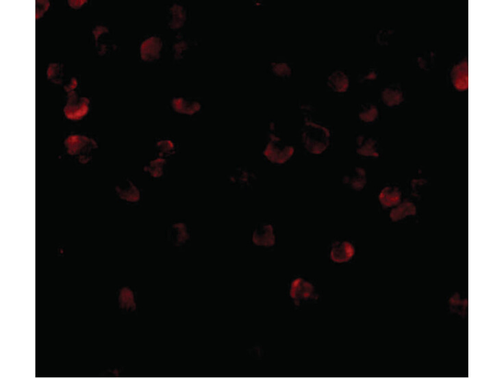 Immunofluorescence of ADAP Antibody
