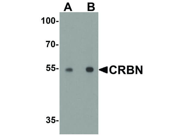Western Blot of CRBN Antibody