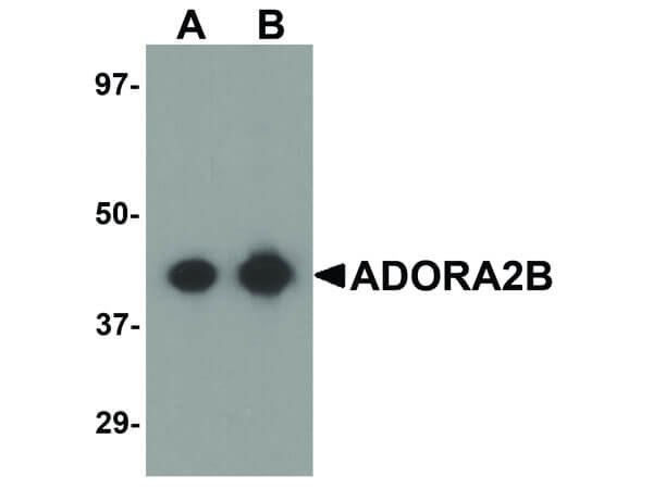 Western Blot of ADORA2B Antibody