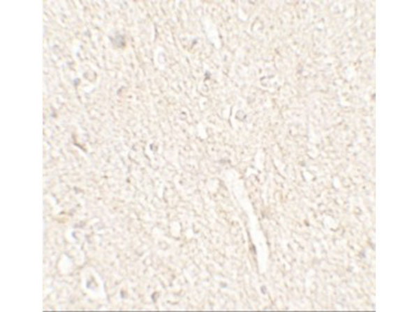 Immunohistochemistry of ADROPIN