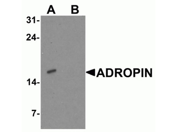 Western blot of ADROPIN