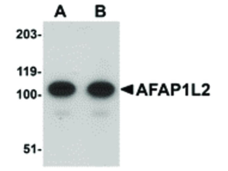 Western Blot of AFAP1L2 Antibody