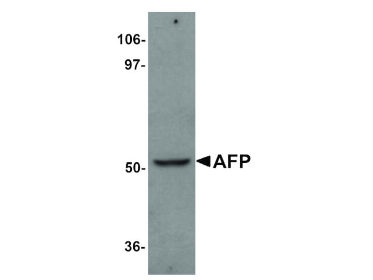 Western Blot of AFP Antibody