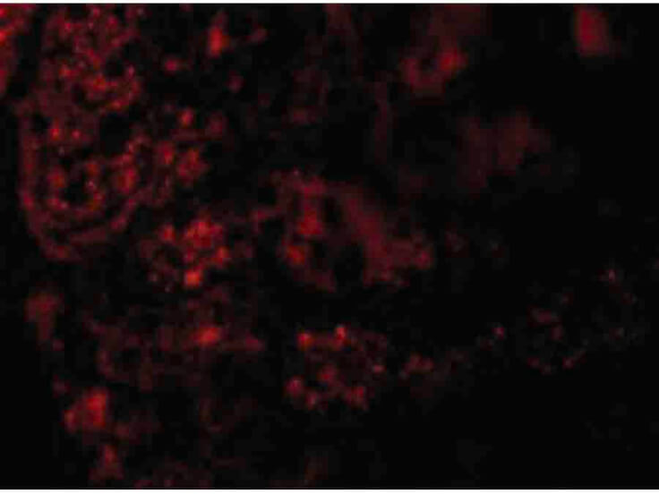 Immunofluorescence of AGTR1 Antibody