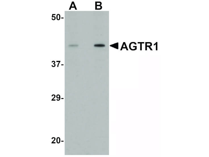 Western Blot of AGTR1 Antibody