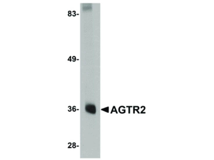 Western Blot of AGTR2 Antibody