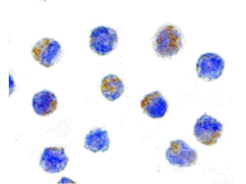 Immunocytochemistry of AIF Antibody