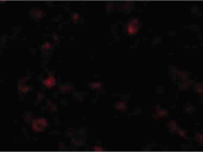Immunofluorescence of AIM Antibody
