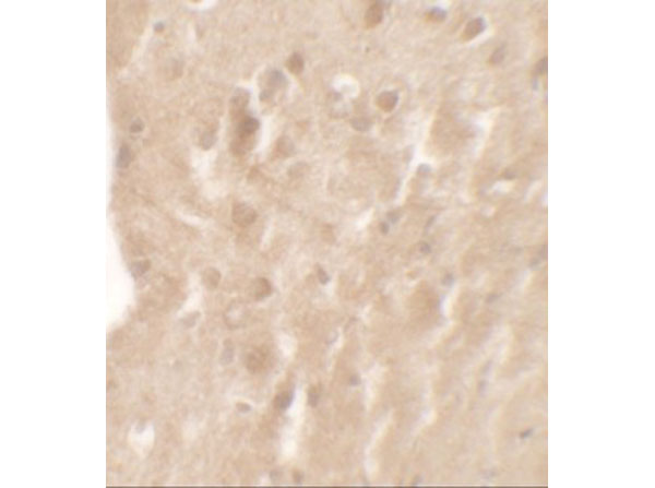 Immunohistochemistry of AIMP1