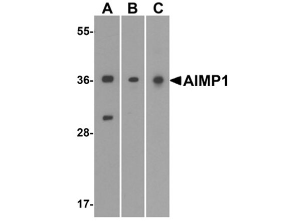 Western blot of AIMP1