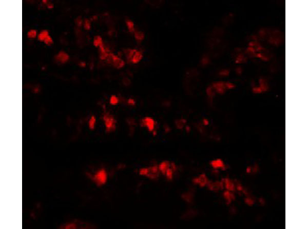 Immunofluorescence of AIMP2
