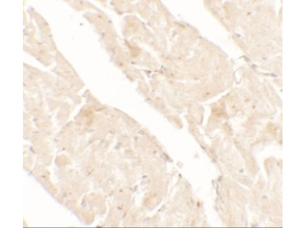 Immunohistochemistry of AIMP2