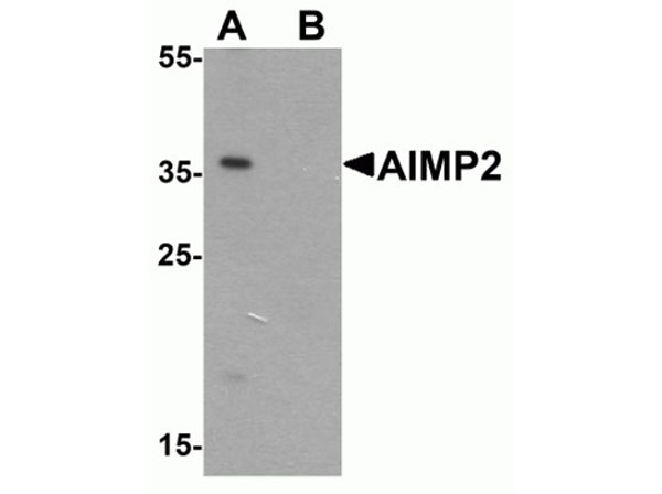 Western blot of AIMP2