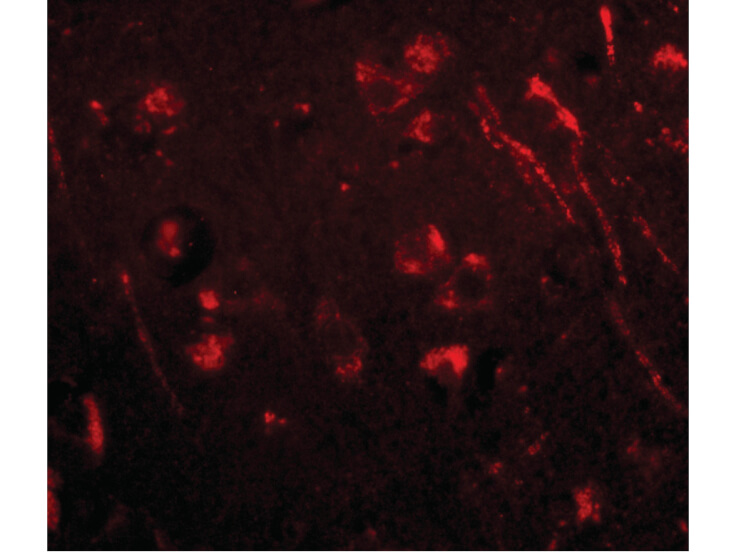 Immunofluorescence of Aipl1 Antibody
