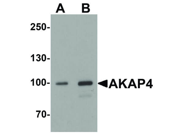 Western Blot of AKAP4 Antibody