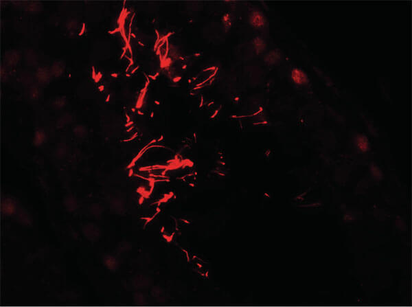 Immunofluorescence of AKAP4 Antibody