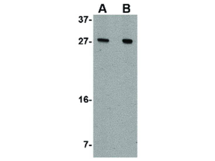 Western Blot of Akirin1 Antibody