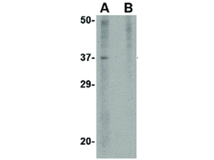 Western Blot of Akirin2 Antibody