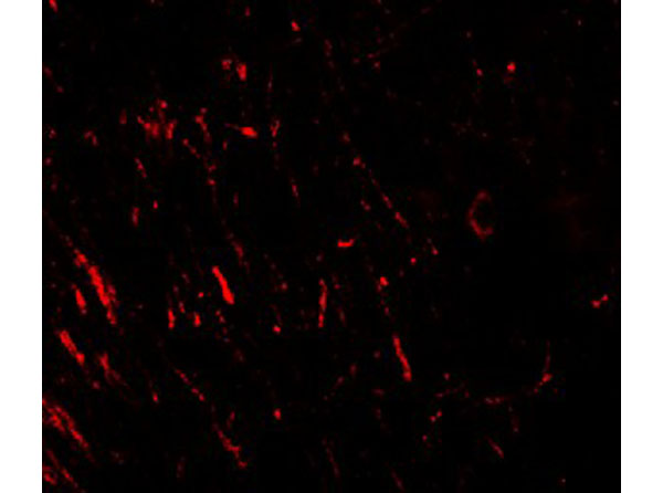 Immunofluorescence of AKT1S1