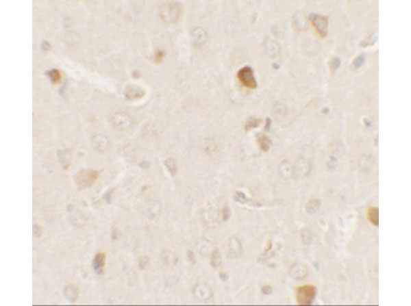 Immunohistochemistry of AKT1S1