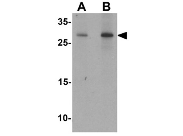 Western blot of AKT1S1