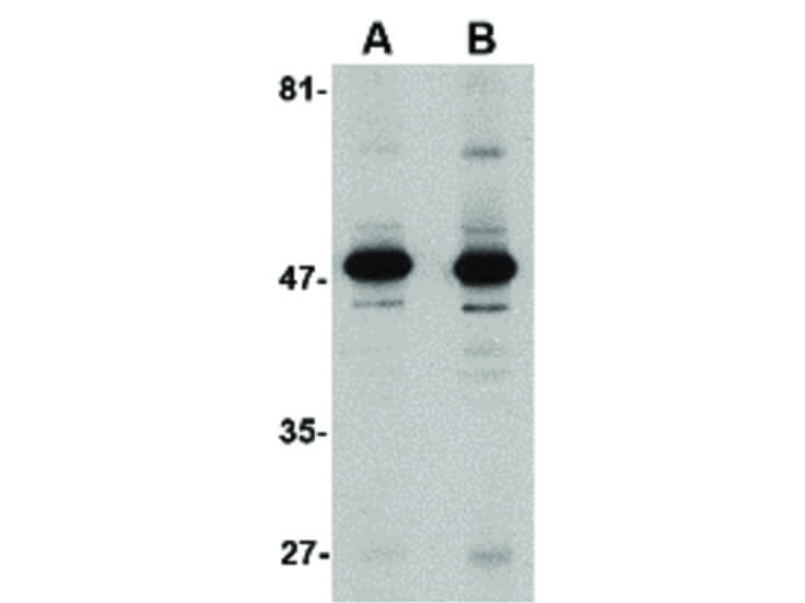 Western Blot of Aldh3A1 Antibody