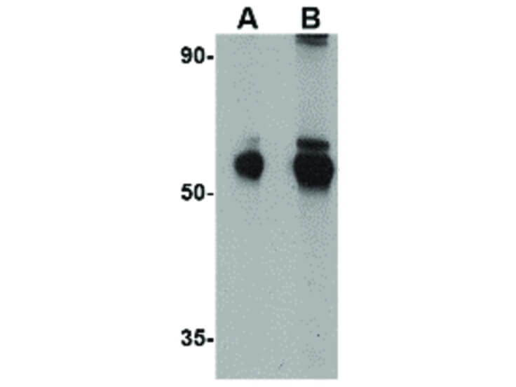 Western Blot of Aldh5A1 Antibody