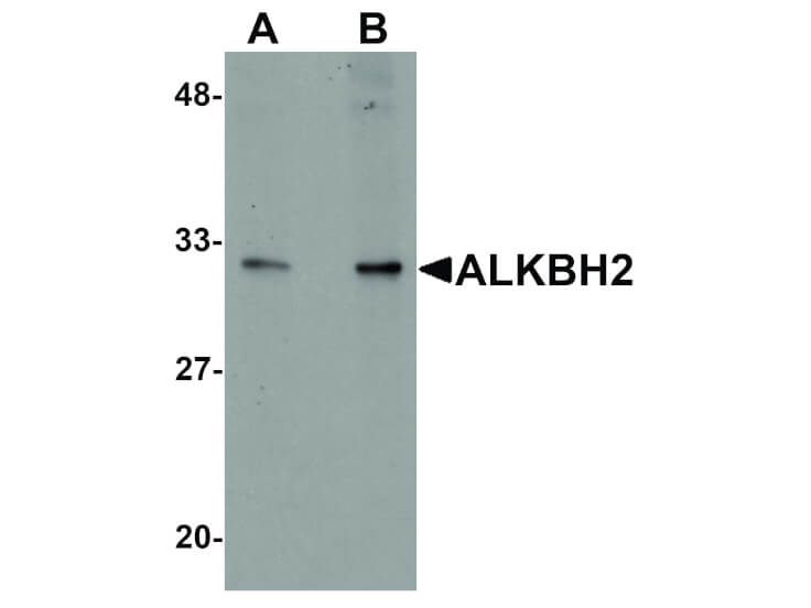 Western Blot of ALKBH2 Antibody