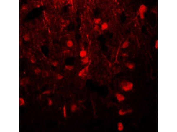 Immunofluorescence of Alpha-tubulin