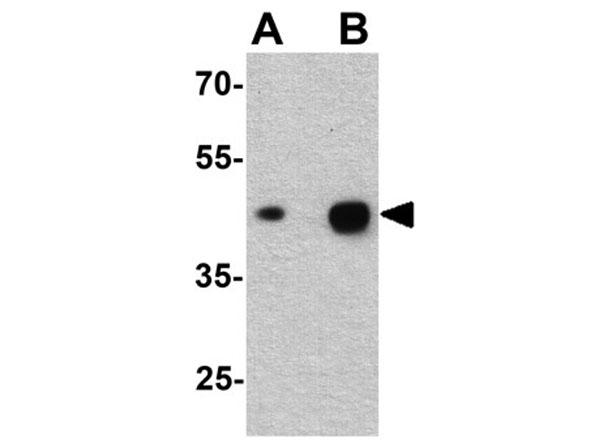 Western blot of alpha-tubulin
