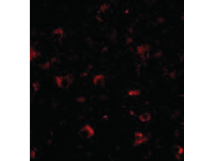Immunofluorescence of Ambra1 Antibody