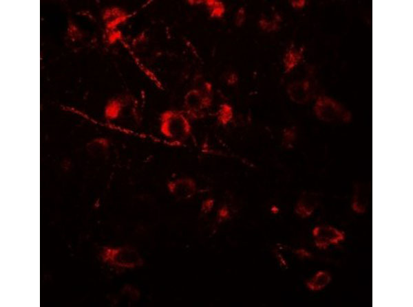 Immunofluorescence of AMIGO1