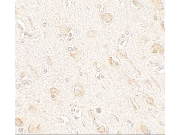 Immunohistochemistry of AMIGO1