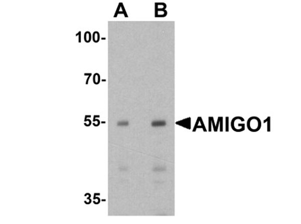 Western blot of AMIGO1