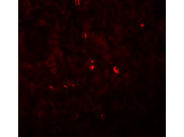 Immunofluorescence of ANG