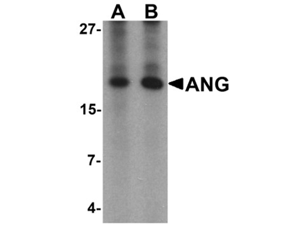 Western blot analysis of ANG