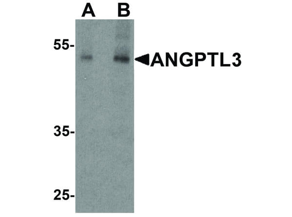 Western Blot of ANGPTL3 Antibody