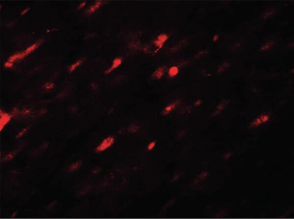 Immunofluorescence of ANGPTL3 Antibody