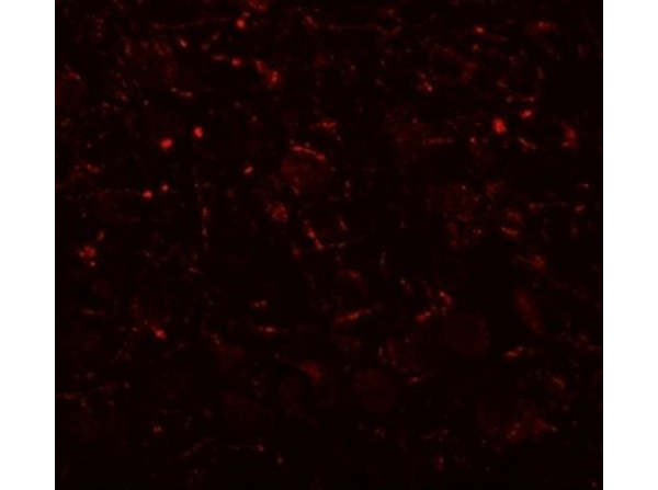Immunofluorescence of AP3B2
