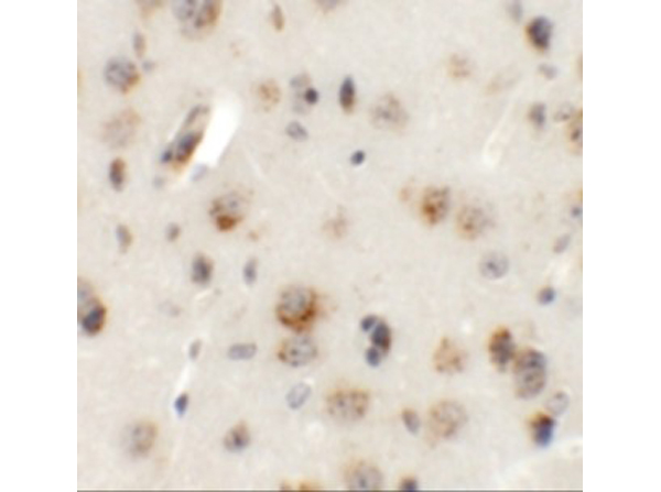 Immunohistochemistry of AP3B2
