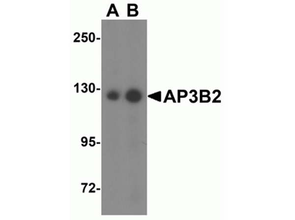 Western blot analysis of AP3B2