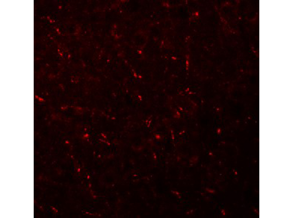 Immunofluorescence of AP3M1