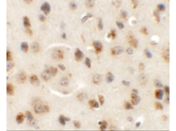 Immunohistochemistry of AP3M1