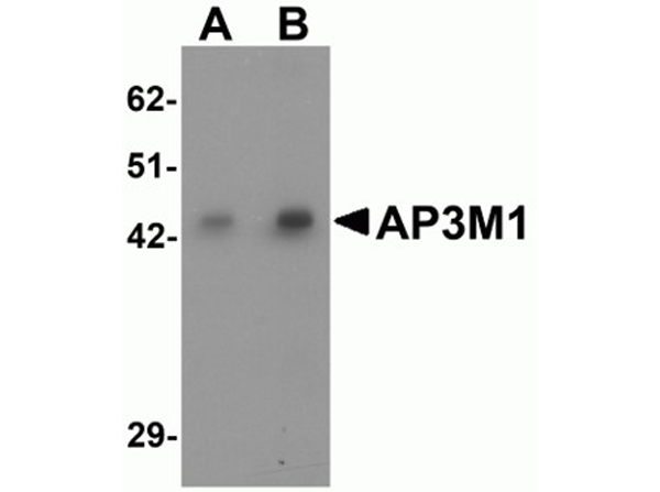 Western blot analysis of AP3M1