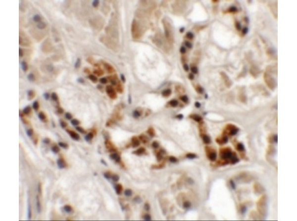 Immunohistochemistry of AP3S1