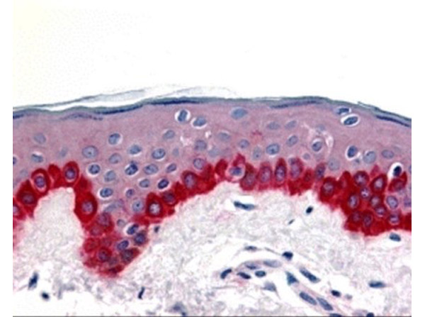 Immunohistochemistry of Apaf1