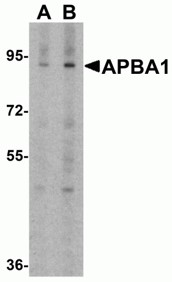 Western blot analysis of APBA1.