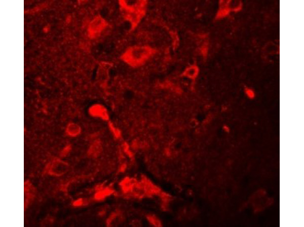 Immunofluorescence of APBA2